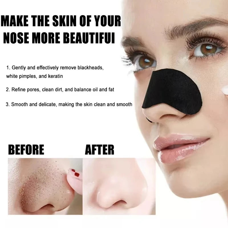 Deep Cleansing Nose Pores And Blackheads